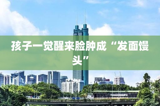 孩子一觉醒来脸肿成“发面馒头”